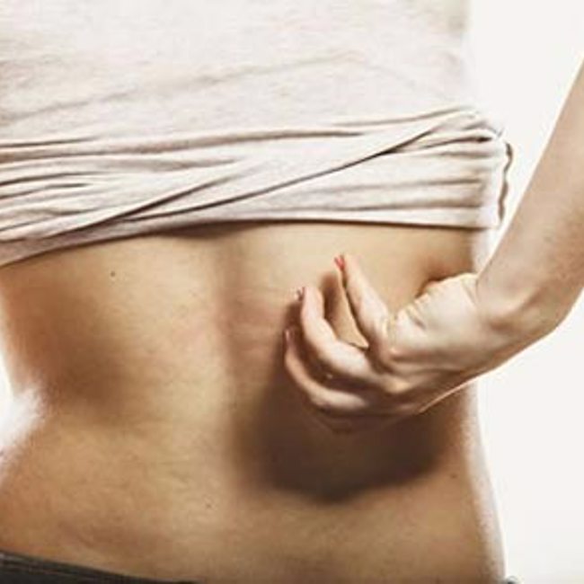 Shingles Virus