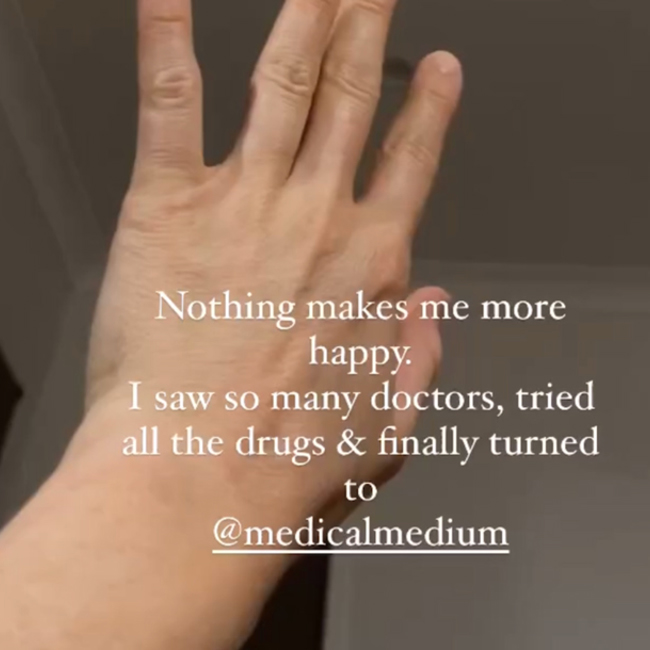 Dermatitis Ridden To Clear Skin