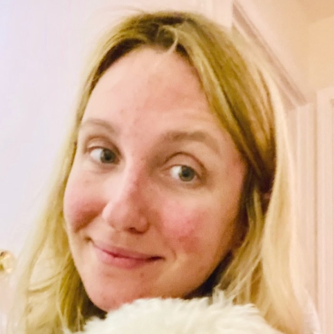 Rosacea Before & After